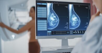 mamografia