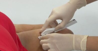 Médicos da rede pública passam por capacitação do método contraceptivo Implanon