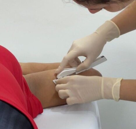 Médicos da rede pública passam por capacitação do método contraceptivo Implanon